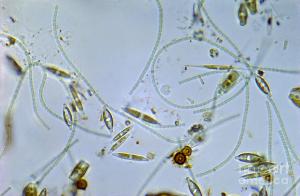http://images.fineartamerica.com/images-medium-large/pond-scum-bright-field-microscope-m-i-walker.jpg